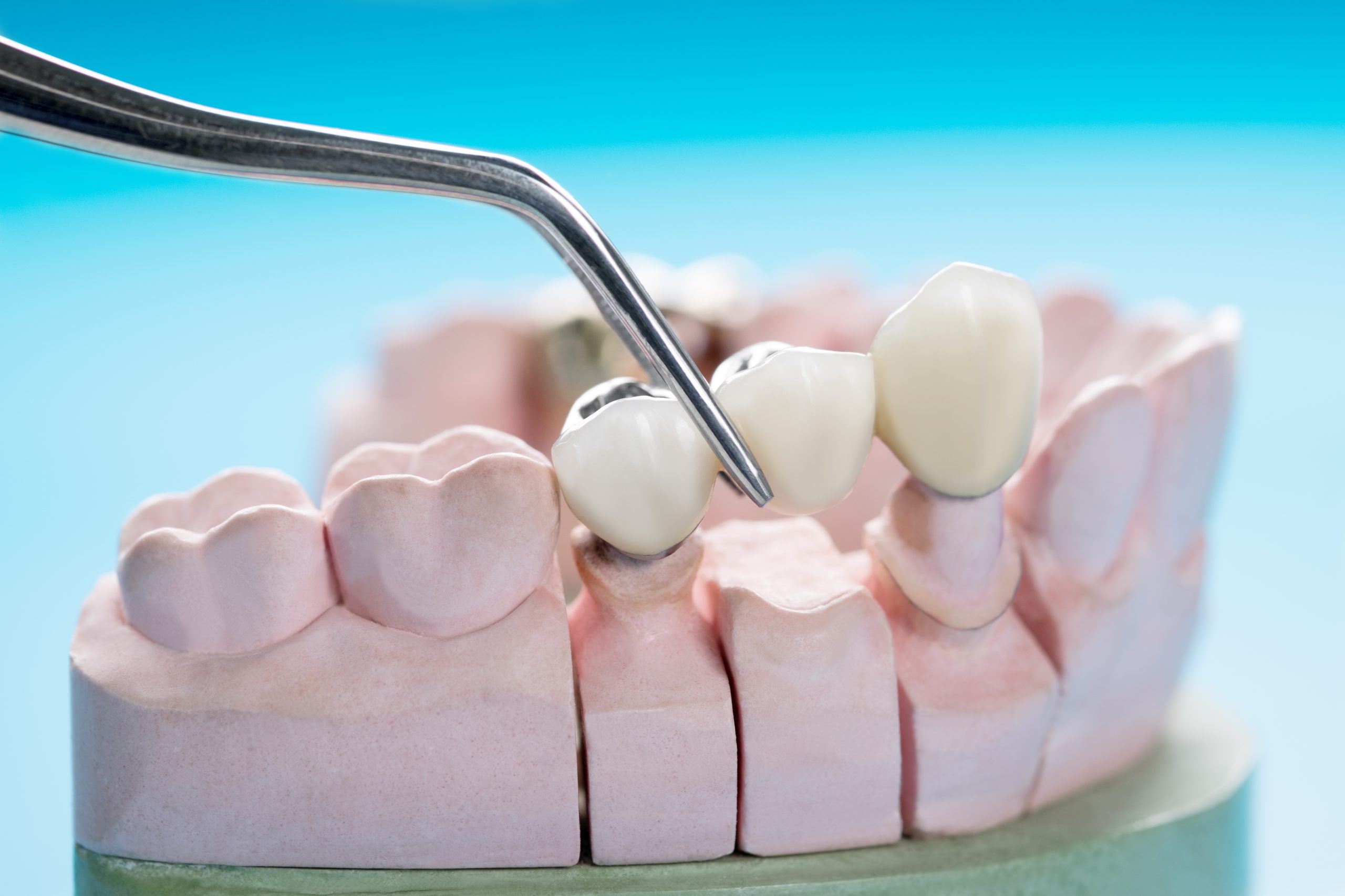 klinike dentare sherbimet